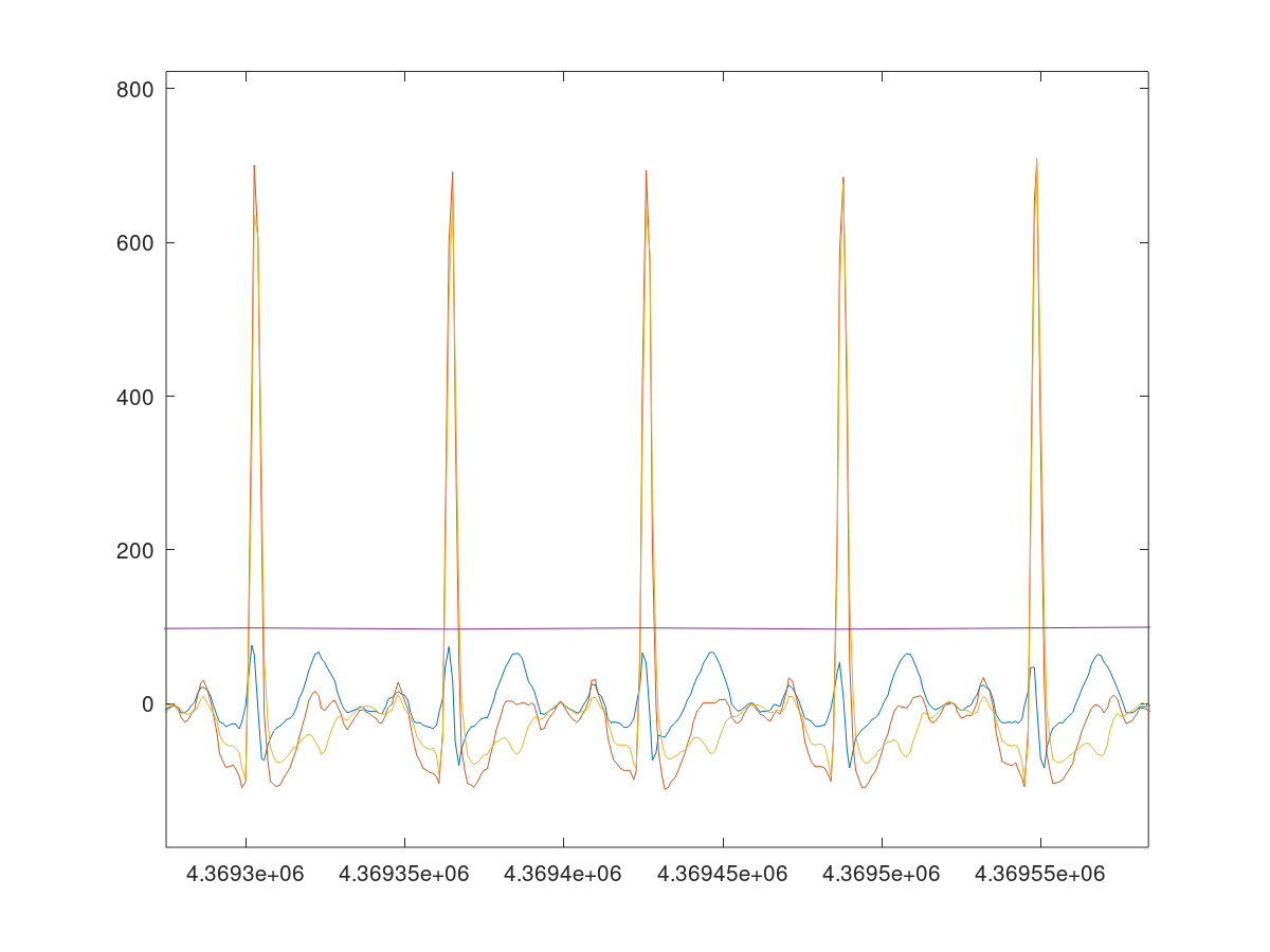 Plot of the EKG signals