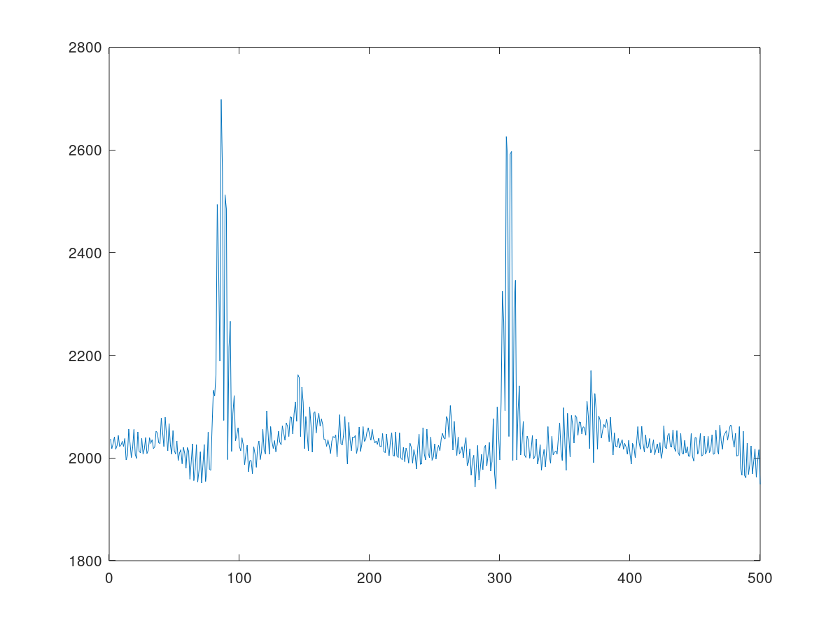 Plot of the EKG signals