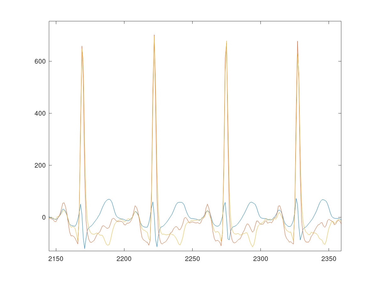 Plot of the EKG signals